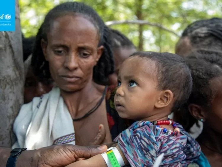 W północnej Etiopii liczba niedożywionych dzieci wzrosła dziesięciokrotnie, alarmuje UNICEF