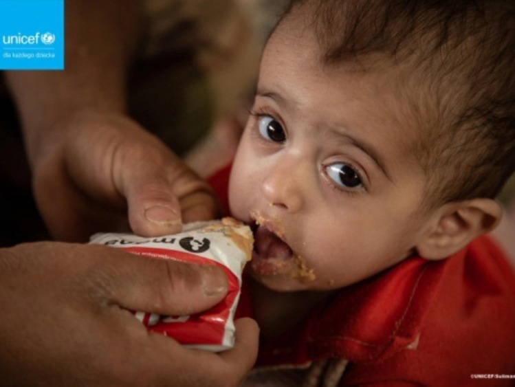 690 mln ludzi na świecie cierpi głód. Świat przegrywa walkę z niedożywieniem!