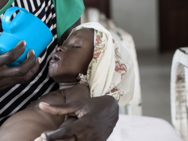 Ćwierć miliona dzieci w Sudanie Południowym cierpi z powodu niedożywienia. UNICEF Polska apeluje o pomoc!
