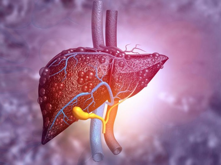 We wczesnej diagnostyce chorób wątroby olbrzymią rolę odgrywają lekarze rodzinni